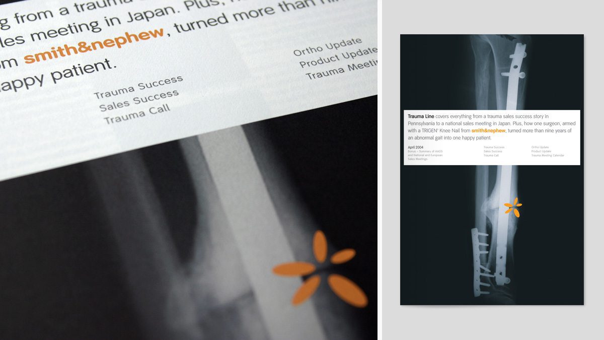 Magazine for Smith+Nephew Orthopaedics